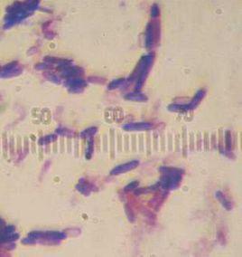 酪酸梭菌 酪酸梭菌