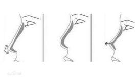 韓式鼻部整形手術 韓式鼻部整形手術