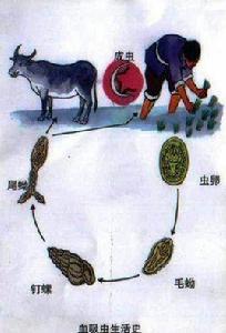 腸道血吸蟲病 腸道血吸蟲病