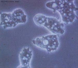 食腦阿米巴原蟲 食腦阿米巴原蟲