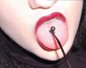 舌釘