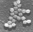 腺病毒性角結膜炎 腺病毒性角結膜炎