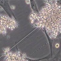 非淋球菌尿道炎 非淋球菌尿道炎