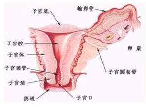 子宮肌瘤