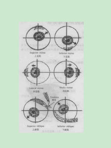 痛性眼肌麻痹 痛性眼肌麻痹