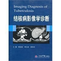 《結核病影像學診斷》