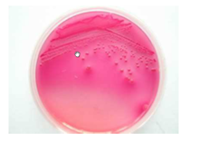 大腸桿菌在去氧膽酸鹽瓊脂上的形態
