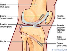十字韌帶結構圖解