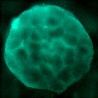 骨形態發生蛋白 骨形態發生蛋白