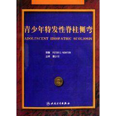 青少年特發性脊柱側彎 青少年特發性脊柱側彎
