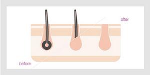 CosBeauty可思美IPL光子脫毛儀