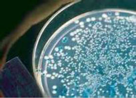 藍白斑篩選原理