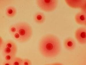 女性支原體衣原體 女性支原體衣原體