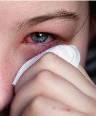 視網膜脫落 視網膜脫落