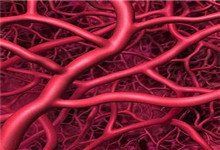 小兒先天性肌強直綜合徵 小兒先天性肌強直綜合徵