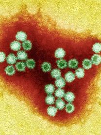 顯微鏡下的諾如病毒