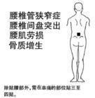 中醫外科膏藥 中醫外科膏藥