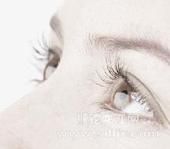 老年性白內障 老年性白內障