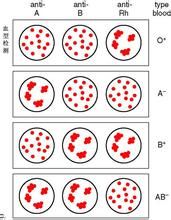 ABO血型鑑定