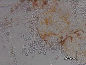 安卡紅麴黴 安卡紅麴黴