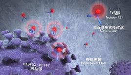 腫瘤介入微創療法 腫瘤介入微創療法