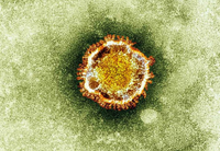 SARS病毒