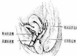 便稀時經陰道排出 便稀時經陰道排出