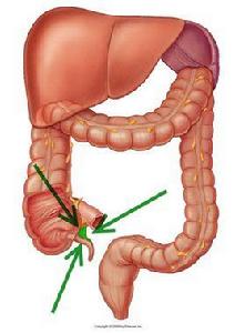 闌尾系膜 闌尾系膜