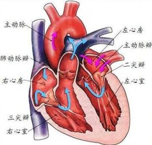 小兒先天性心臟病