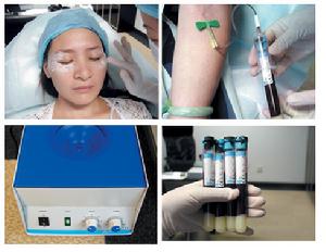 （圖）手術去皺