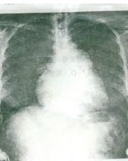 代謝性鹼中毒 代謝性鹼中毒