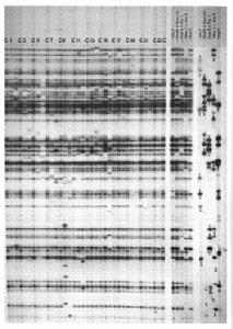 DNA指紋圖譜