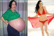 納迪亞&middot;蘇爾曼產後瘦身成功