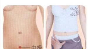 經前期緊張綜合徵