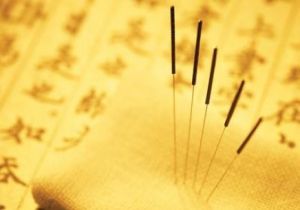 中醫針灸法
