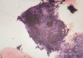 線索細胞 線索細胞