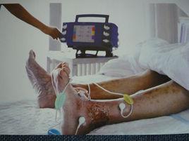 序貫治療 序貫治療