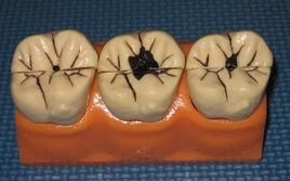 牙科材料 牙科材料