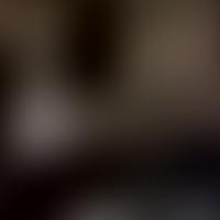 NGC 5158 RASS 彩色圖