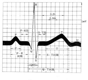 心電圖指標解釋