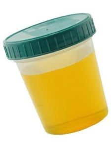 尿常規酸鹼度 尿常規酸鹼度