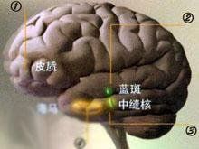 中樞神經興奮藥中毒