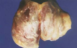 雞大腸桿菌 雞大腸桿菌