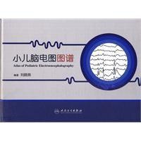 小兒腦電圖圖譜 小兒腦電圖圖譜