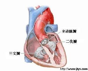 主動脈瓣閉鎖不全