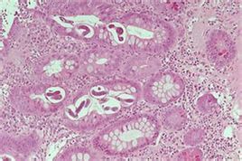 腫瘤標誌物 腫瘤標誌物