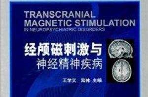 經顱磁刺激與神經精神疾病 經顱磁刺激與神經精神疾病