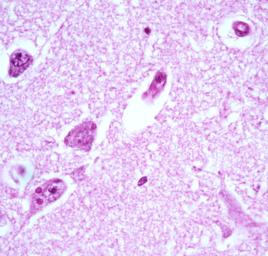 次生夾雜物 次生夾雜物