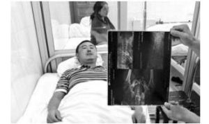 與警方發生衝突後，受傷家屬接受治療