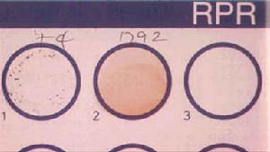 原發變態反應素
